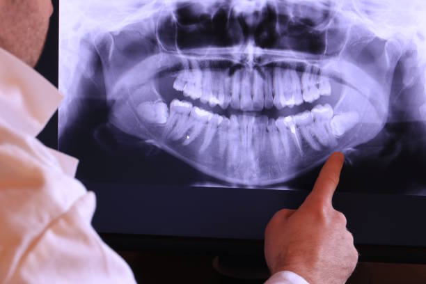 Best Emergency Treatment for Toothache in Bristow, OK