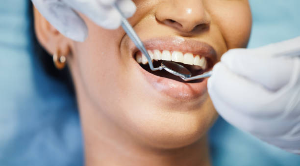 Best Emergency Tooth Extraction in Bristow, OK